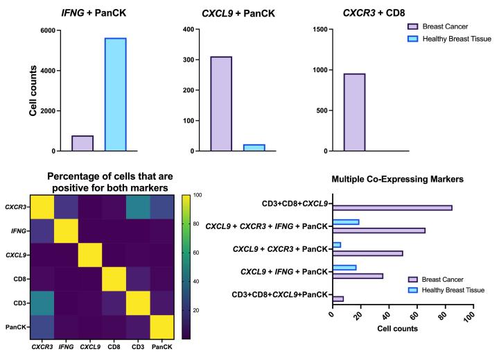 AI-Driven Image Analysis IFNG PanCK
