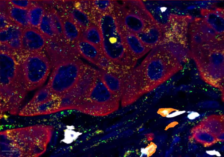 Results - Positive Control Multiomic Staining in Breast Cancer