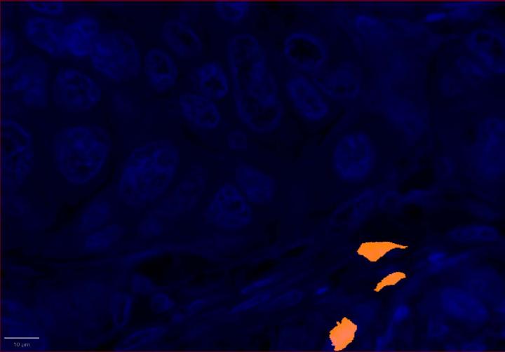 CD8 Positive Control Multiomic Staining in Breast Cancer