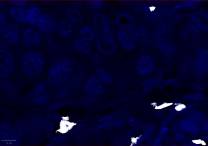 CD3 Positive Control Multiomic Staining in Breast Cancer