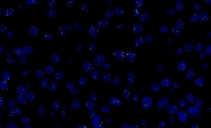 Breast-Cancer-Tissue-CASE1-63x-Oil-Cell-FISH-DRO-Slide4-001-750x454