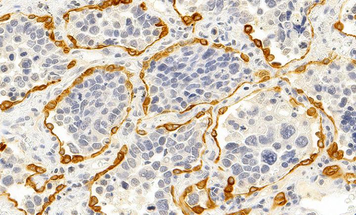 Oil-Tissue-FISH-DGG-T2-253B3-CK-40x-0220-4