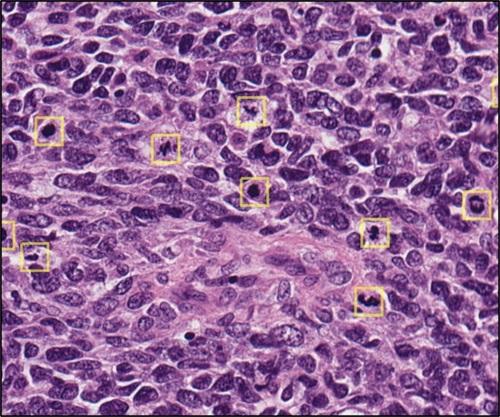 MitPro-Next-Generation-Mitosis-Profiling-
