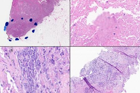 H&E slides depicting four types of digital pathology artifacts