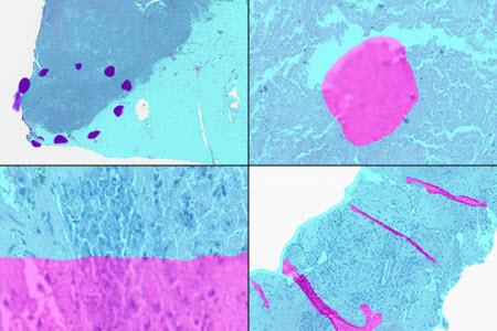 SlideQC BF markup of four types of artifacts