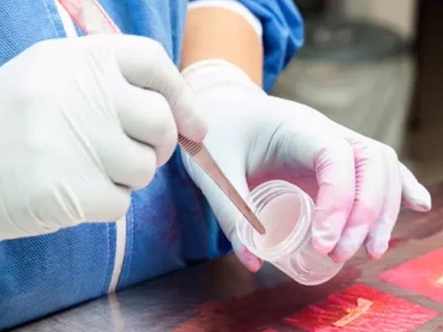 fixation-and-fixatives-1-the-process-of-fixation-and-the-nature-of-fixatives-640x480