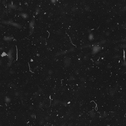 Glass microscope slide coverslips are better than film coverslips because the produce clean images with minimal artifacts and no longitudinal scratches.