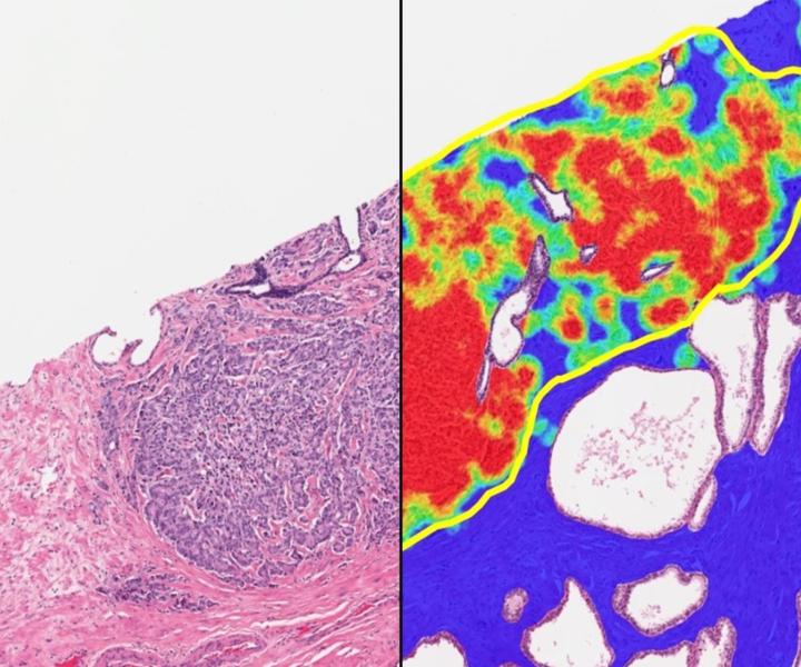 Prostate Macrodissect AI Split ROI