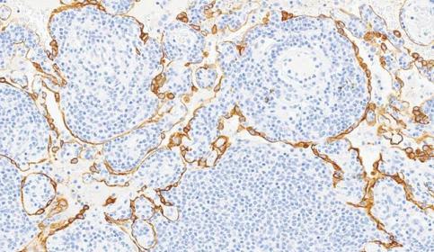 multi-tissue-card-640x410