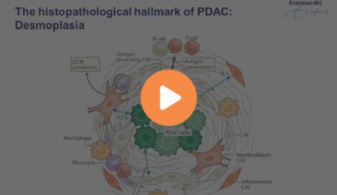 characterization-of-the-pancreatic-tumor-microenvironment-using-novel-quantitative-multiplex-dps-640x410