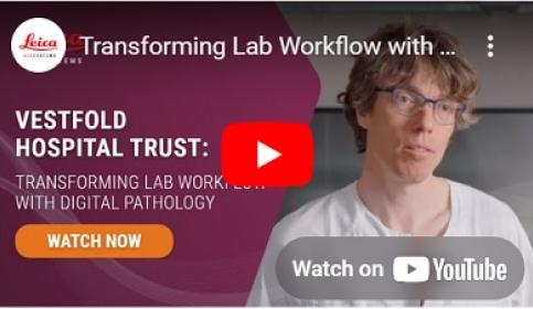 Vestfold-Hospital-Trust-Transforming-Lab-Workflow-with-Digital-Pathology​-400x226