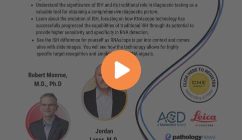 The-RNAscope-IHC-Breakthrough-When-Clarity-Matters-640x410