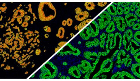 halo-Area-Quantification-FL