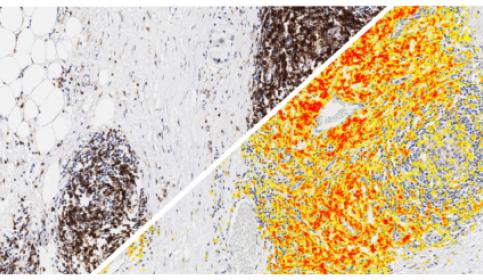 halo-Area-Quantification