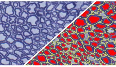 halo-Axon-Quantification
