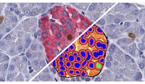 halo-Islet-Quantification
