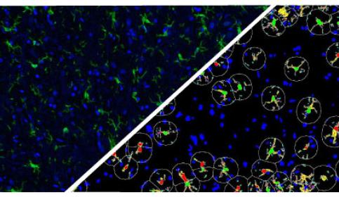 halo-Microglial-Activation-FL