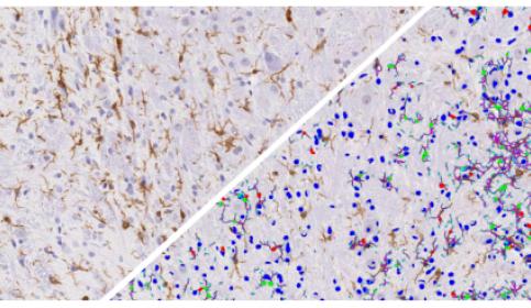 halo-Microglial-Activation