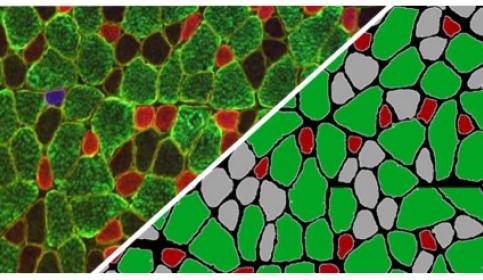 halo-Muscle-Fiber-FL