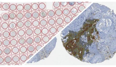 halo-TMA-Tissue-Microarray-Add-On