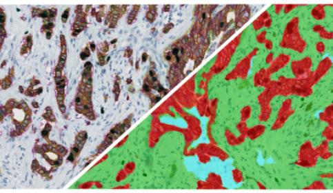 halo-Tissue-Classifier-Add-on