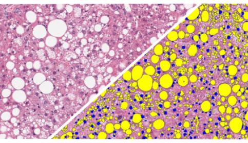 halo-Vacuole-Quantification