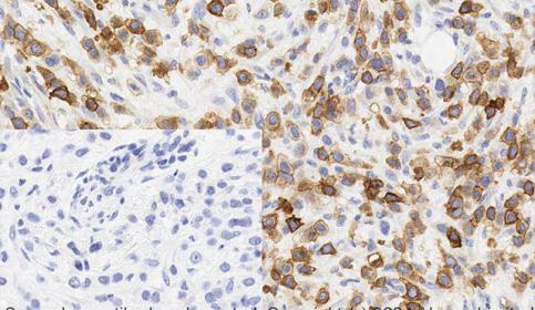 Histology slide stain using BOND RX and abcam Rabbit Monoclonal Anti-B7H4 antibody