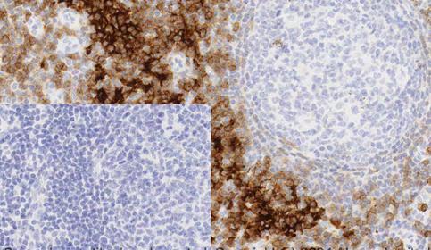Histology slide stain using BOND RX and abcam Rabbit Monoclonal Anti-CCR7 antibody