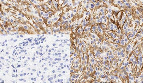 Histology slide stain using BOND RX and abcam Rabbit Monoclonal Anti-PDGFR alpha and PDGFR beta antibody
