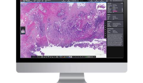 Aperio HALO AP AI-powered digital pathology management software
