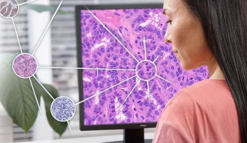 Digital Pathology
