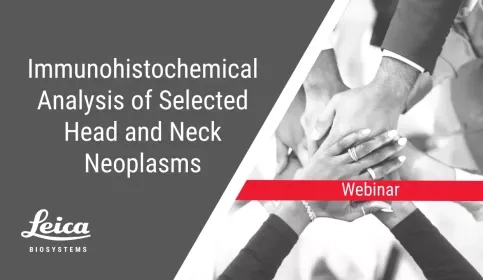 Immunohistochemical Analysis of Selected Head and Neck Neoplasms Webinar Thumbnail