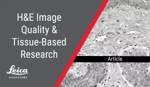 H&E Image Quality and Tissue-Based Research Article Thumbnail