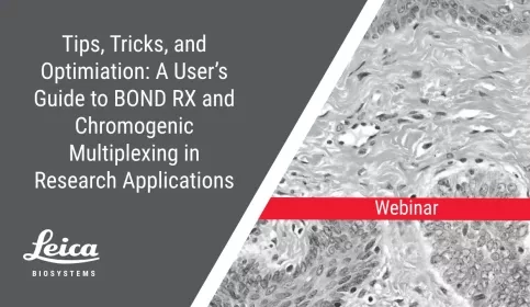 Tips, Tricks, and Optimization: A User's Guide to BOND RX and Chromogenic Multiplexing in Research Applications Webinar Thumbnail