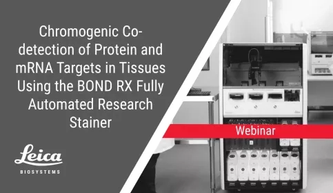 Chromogenic Co-Detection of Protein and mRNA Targets in Tissues Using the BOND RX Fully Automated Research Stainer Webinar Thumbnail