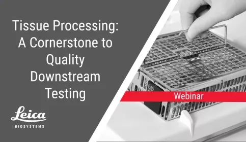 Tissue Processing: A Cornerstone to Quality Downstream Testing Webinar Thumbnail