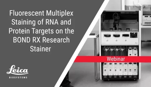 Fluorescent Multiplex Staining of RNA and Protein Targets on the BOND RX Webinar Thumbnail