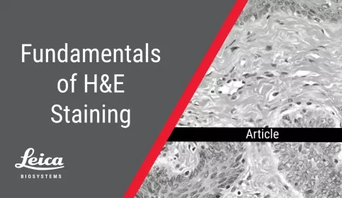 Fundamentals of H&E Staining Article Thumbnail