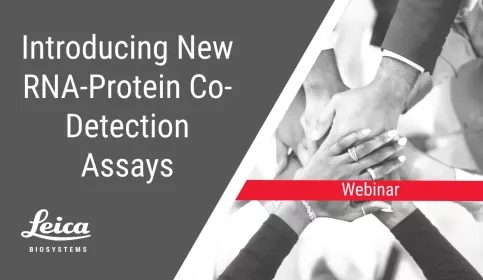 Introducing New RNA-Protein Co-Detection Assays Webinar Thumbnail