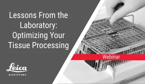 Lessons from the Laboratory: Optimizing Your Tissue Processing Webinar Thumbnail
