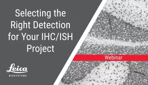 Selecting the Right Detection For Your IHC/ISH Project Webinar Thumbnail