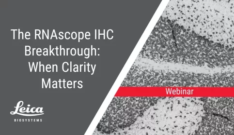 RNAscope IHC Staining Breakthrough Clarity Webinar Thumbnail