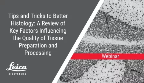 Tips and Tricks to Better Histology: A Review of Key Factors Influencing the Quality of Tissue Preparation and Processing Webinar Thumbnail