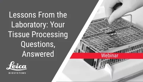 Lessons From the Laboratory: Your Tissue Processing Questions, Answered Webinar Thumbnail