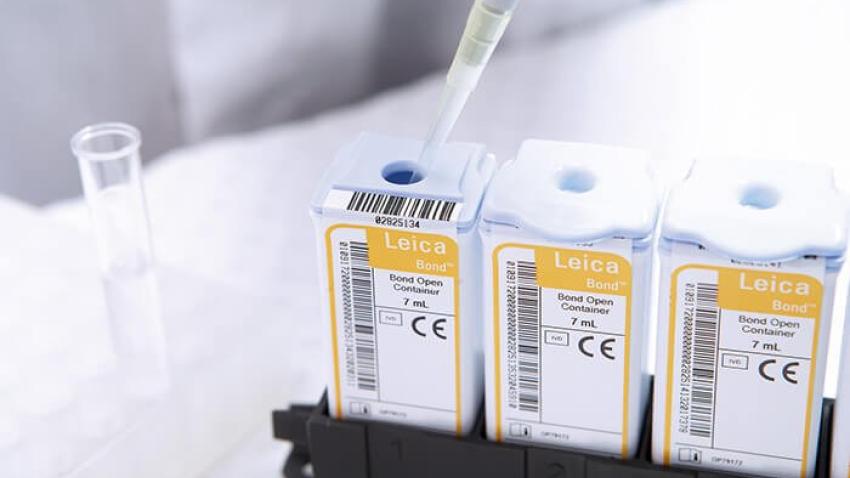 Get Started Right Away with BOND RX
