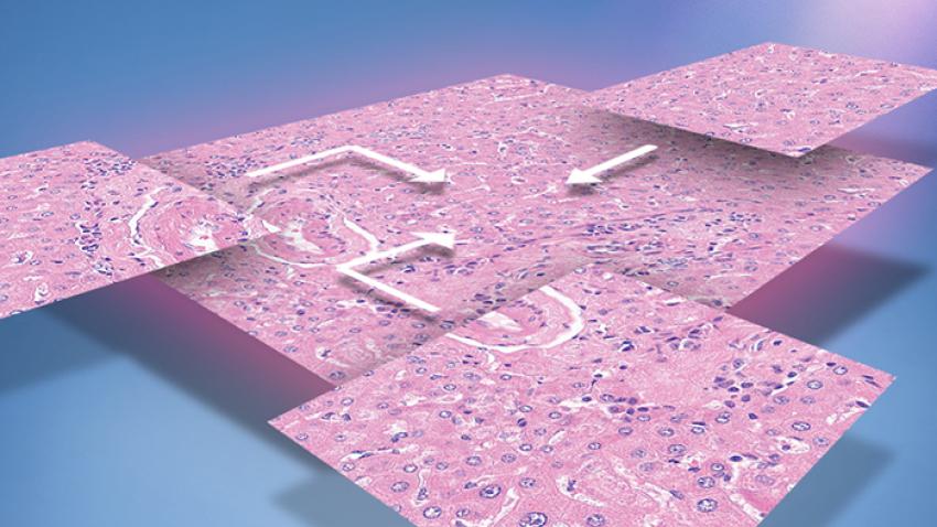 Extended-Focus-700x400