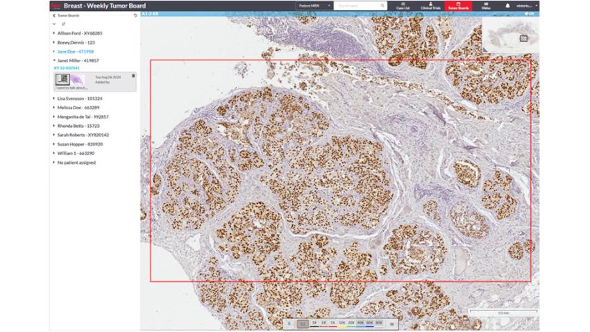 Multidisciplinary Team Meetings 