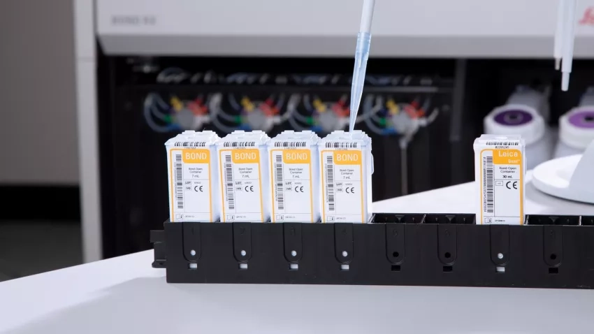 BOND-RX Features Operations