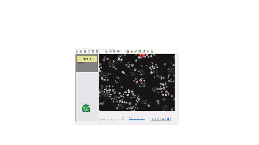 CytoVision-DX-FLMet-InterScan20x