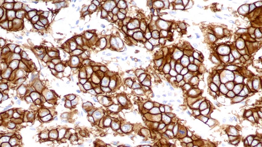 Bond Oracle HER2 IHC System Diagnostic Confidence